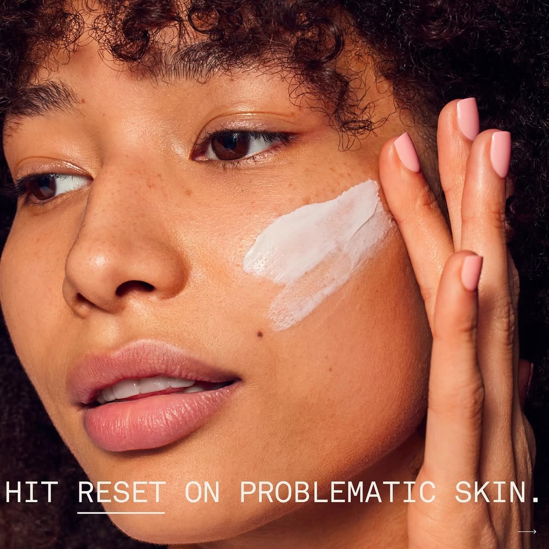 Sofie Pavitt Reset Benzoyl Peroxide Acne Treatment Mask